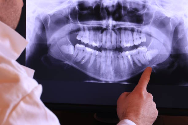 Best Emergency Treatment for Oral Infections in Goose Creek, SC