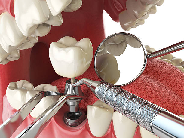 Best Emergency Treatment for Jaw Pain or Injury in Goose Creek, SC
